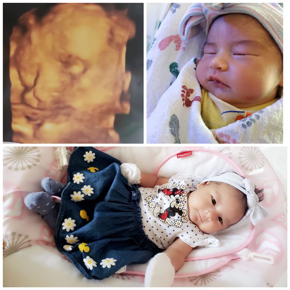 collage of images of alma marceleno's tr baby girl