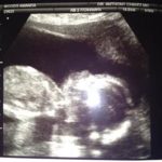 ultrasound of Amanda Woods TR baby