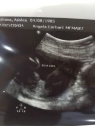 ultrasound images of ashley williams tubal reversal pregnancy