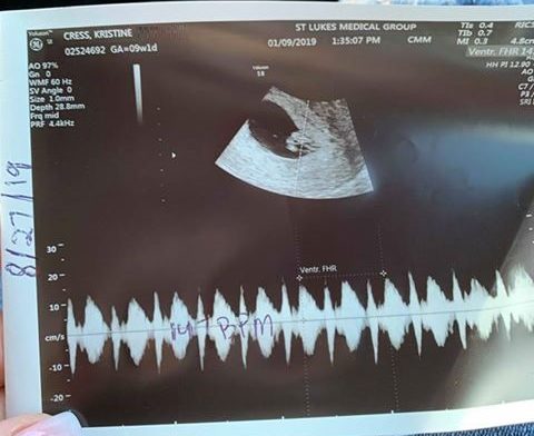 Kristine Steadham Announces TR Baby is Coming by sharing her 7-week ultrasound
