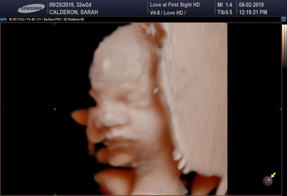 3-d ultrasound of sarah calderon's baby girl coming after having 4 boys