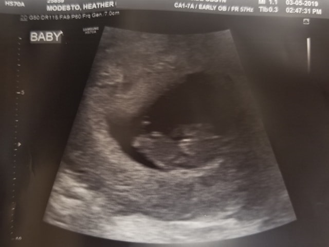 heather modesto's ultrasound of her fourth tubal reversal baby on its way