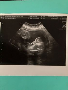 elia rosales announces tubal reversal pregnancy with this ultrasound