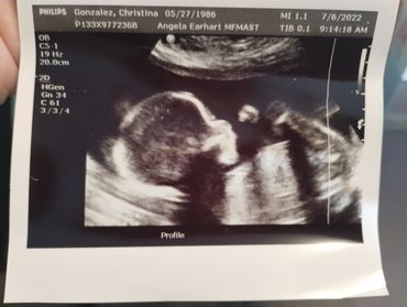 ultrasound showing daniela arthur's 3rd tubal reversal baby due november 2022