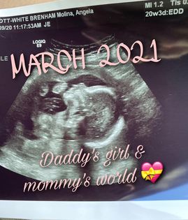 angie molina castanon announcing her tubal reversal baby is due march 2021 with a picture of her ultrasound