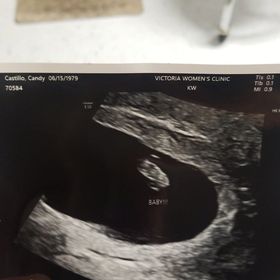 ultrasound of 2nd tubal reversal baby for candy mcwhorter