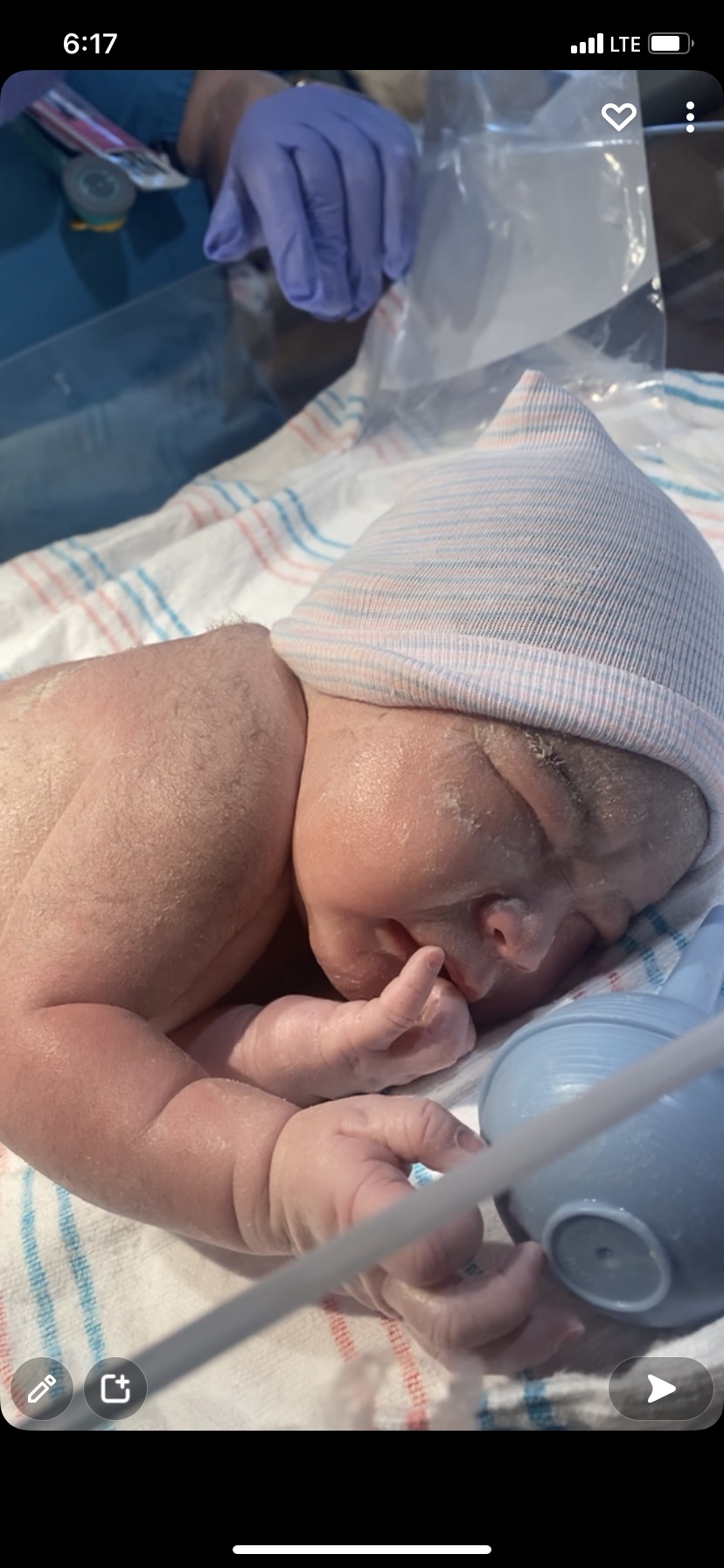 newborn tubal reversal baby after elizabeth medina's surgery with doctor rosenfeld