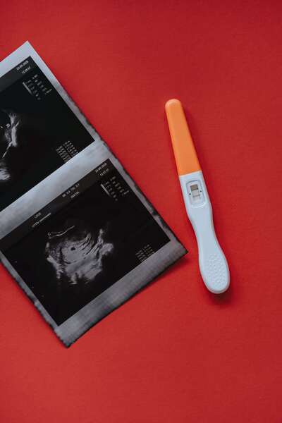 ultrasound and a positive pregnancy test