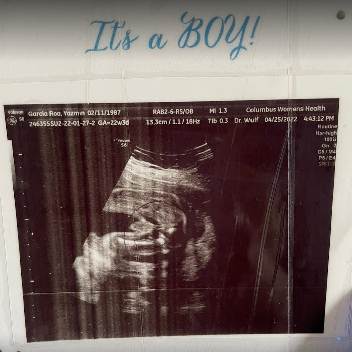 ultrasound of yazmin garcia's tubal reversal baby boy